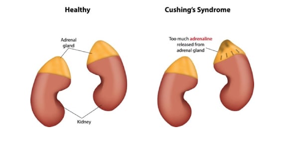 Define The Following Diseases Of The Cushing's Syndrome Flashcards